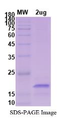 SDS-PAGE (GFAP-2745H).jpg
